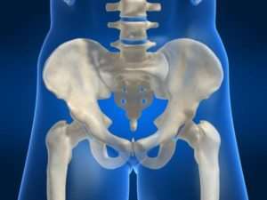 La osteotomía periacetabular como alternativa a la prótesis en jóvenes con displasia de cadera